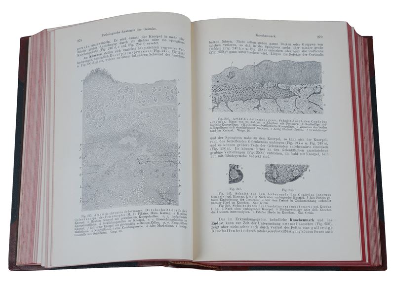 Lehrbuch Der Speziellen Pathologischen Anatomie von Dr. Ernst Ziegler